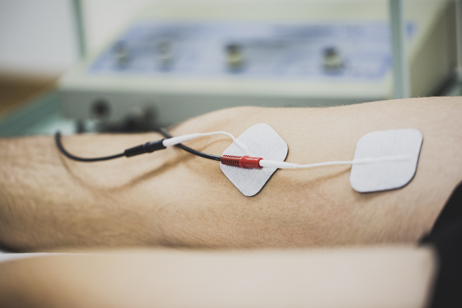 neuromodulacion-ayensa-fisio Fibrólisis diacutánea en Ayensa fisioterapia Zaragoza